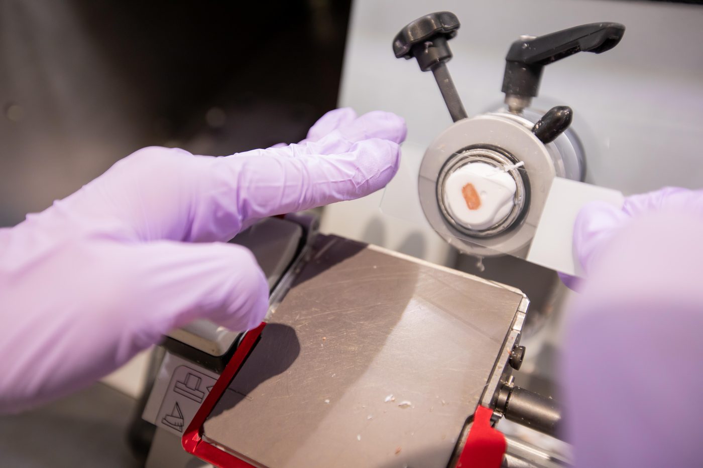 Tissue suitability assessment